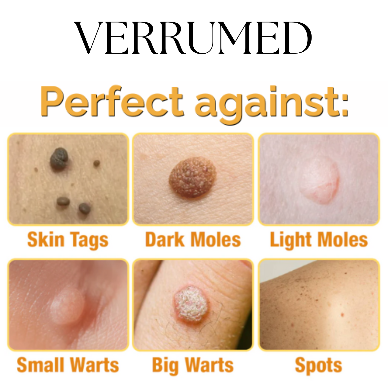 VERRUMED-1.png VERRUMED-1.png